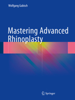 Mastering Advanced Rhinoplasty 3662497042 Book Cover