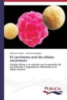 El Carcinoma Oral de Celulas Escamosas 3639553543 Book Cover