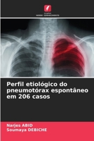 Perfil etiológico do pneumotórax espontâneo em 206 casos (Portuguese Edition) 620838253X Book Cover