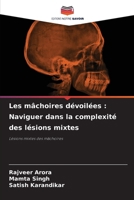 Les mâchoires dévoilées: Naviguer dans la complexité des lésions mixtes (French Edition) 6208152178 Book Cover