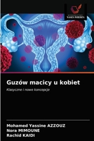 Guzów macicy u kobiet 6202648589 Book Cover