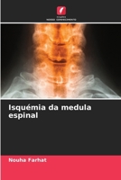 Isquémia da medula espinal (Portuguese Edition) 6207904303 Book Cover