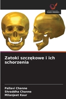 Zatoki szczekowe i ich schorzenia (Polish Edition) 6209734553 Book Cover