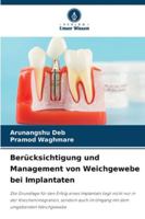Berücksichtigung und Management von Weichgewebe bei Implantaten (German Edition) 6208472598 Book Cover