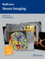 Neuro Imaging 1604061898 Book Cover
