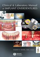 Clinical and Laboratory Manual of Implant Overdentures 0813808812 Book Cover