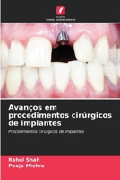 Avanços em procedimentos cirúrgicos de implantes: Procedimentos cirúrgicos de implantes 6207635132 Book Cover