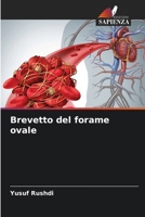 Brevetto del forame ovale (Italian Edition) 6208238609 Book Cover