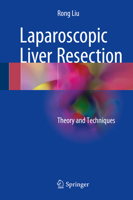 Laparoscopic Liver Resection: Theory and Techniques 9402414088 Book Cover
