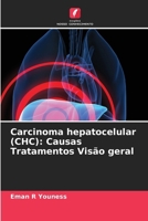 Carcinoma hepatocelular (CHC): Causas Tratamentos Visão geral (Portuguese Edition) 6208341167 Book Cover