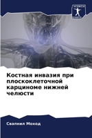 Костная инвазия при плос 6205286858 Book Cover