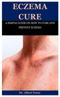Eczema Cure: A SIMPLE GUIDE ON HOW TO CURE AND PREVENT ECZEMA B08F7TFF3L Book Cover