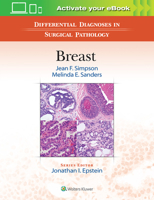 Differential Diagnoses in Surgical Pathology: Breast 1496300653 Book Cover