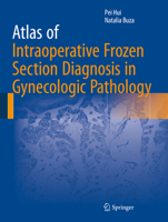 Atlas of Intraoperative Frozen Section Diagnosis in Gynecologic Pathology 3319218069 Book Cover