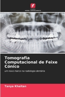 Tomografia Computacional de Feixe Cónico (Portuguese Edition) 6630102282 Book Cover