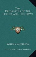 The Deformities of the Fingers and Toes (Classic Reprint) 1120742684 Book Cover