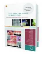 Peri-Implant Tissue Remodeling: Scientific Background and Clinical Implications 8874921667 Book Cover