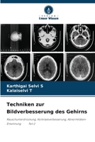 Techniken zur Bildverbesserung des Gehirns: Rauschunterdrückung, Kontrastverbesserung, Abnormitäten-Erkennung Teil 2 620584110X Book Cover