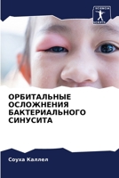 ОРБИТАЛЬНЫЕ ОСЛОЖНЕНИЯ & 6205604264 Book Cover