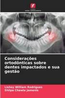 Considerações ortodônticas sobre dentes impactados e sua gestão (Portuguese Edition) 6208157684 Book Cover