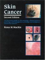 Skin Cancer: An Illustrated Guide to the Aetiology, Clinical Features, Pathology and Management of Benign and Malignant Cutaneous Tumours 0815157169 Book Cover