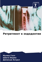 Ретритмент в эндодонтии 6205809036 Book Cover