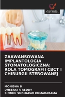 Zaawansowana Implantologia Stomatologiczna: Rola Tomografii Cbct I Chirurgii Sterowanej (Polish Edition) 6630218507 Book Cover