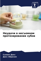 Неудачи в несъемном прот 6205679833 Book Cover