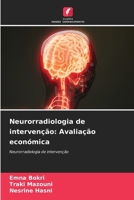 Neurorradiologia de intervenção: Avaliação económica (Portuguese Edition) 6208055253 Book Cover