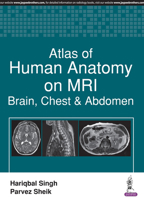 Atlas of Human Anatomy on MRI: Brain, Chest & Abdomen 9386322528 Book Cover