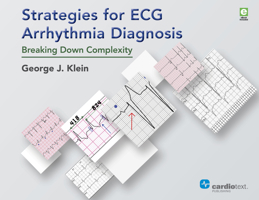 Strategies for ECG Arrhythmia Diagnosis: Breaking Down Complexity 194290911X Book Cover