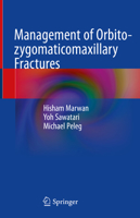 Management of Orbito-Zygomaticomaxillary Fractures 3030426440 Book Cover