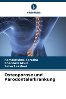 Osteoporose und Parodontalerkrankung 6206236358 Book Cover