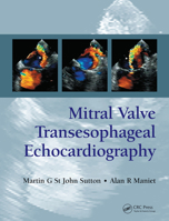 Mitral Valve Transesophageal Echocardiography B000NKMREO Book Cover