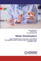 Molar Distalization: Molar distalization is a process in the field of Orthodontics which is used to move first molar teeth distally in arch. 6200535361 Book Cover