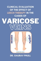 Clinical Evaluation of the Effect of Leech Therapy in the Cases of Varicose Veins 6020591565 Book Cover