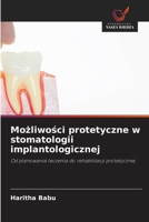 Mozliwosci protetyczne w stomatologii implantologicznej (Polish Edition) 6630221281 Book Cover