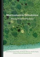 Mini Implants in Orthodontics: History, Design, and Evolution 1036417395 Book Cover