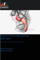 Lesioni precancerose dell'ano 6209121233 Book Cover