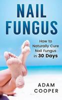 Nail Fungus: How to Naturally Cure Nail Fungus in 30 Days: Natural remedies, homeopathy for toenail fungus 1539416097 Book Cover