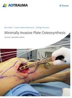 Minimally Invasive Plate Osteosynthesis 3131433922 Book Cover