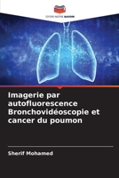 Imagerie par autofluorescence Bronchovidéoscopie et cancer du poumon 6205696037 Book Cover