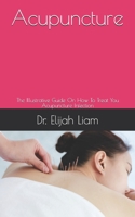 Acupuncture: The Illustrative Guide On How To Treat You Acupuncture Infection B098GX27QM Book Cover