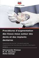 Procédures d'augmentation des tissus mous autour des dents et des implants dentaires 6207325133 Book Cover