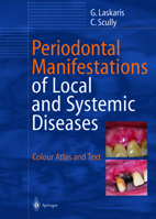 Periodontal Manifestations of Local and Systemic Diseases: Colour Atlas and Text (Periodontal Manifestations of Local and Systemic Diseases) 3642627889 Book Cover