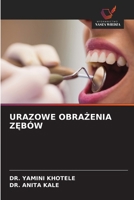 Urazowe ObraZenia ZEbów (Polish Edition) 6209500358 Book Cover