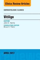 Vitiligo, An Issue of Dermatologic Clinics (Volume 35-2) 0323524044 Book Cover