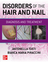 Disorders of the Hair and Nail: Diagnosis and Treatment 1260462471 Book Cover