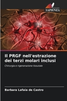 Il PRGF nell'estrazione dei terzi molari inclusi (Italian Edition) 6209459943 Book Cover