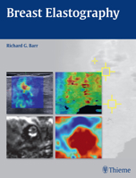 Breast Elastography 1604068523 Book Cover